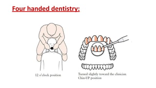 Four handed dentistry:
 