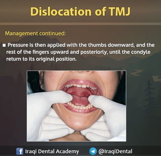 Most common Complications during Dental Extraction: Explained