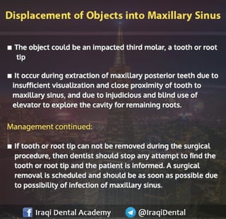 Most common Complications during Dental Extraction: Explained