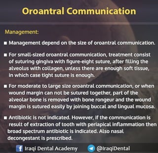 Most common Complications during Dental Extraction: Explained