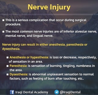 Most common Complications during Dental Extraction: Explained