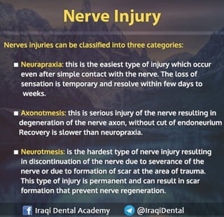 Most common Complications during Dental Extraction: Explained