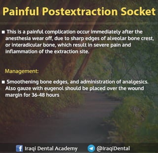 Most common Complications during Dental Extraction: Explained