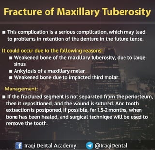 Most common Complications during Dental Extraction: Explained
