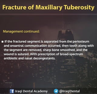 Most common Complications during Dental Extraction: Explained