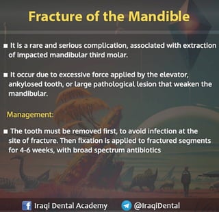 Most common Complications during Dental Extraction: Explained