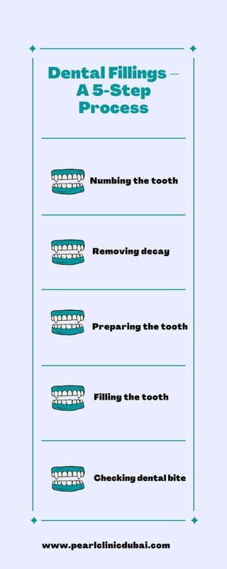 Dental Fillings –
A 5-Step
Process


Numbing the tooth
Removing decay
Preparing the tooth
Filling the tooth
Checking dental bite
www.pearlclinicdubai.com
 