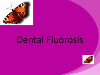 Dental Fluorosis 