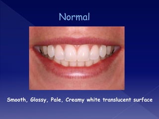 Smooth, Glossy, Pale, Creamy white translucent surface
 