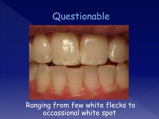 Ranging from few white flecks to
occassional white spot
 