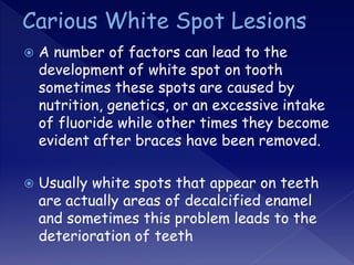  A number of factors can lead to the
development of white spot on tooth
sometimes these spots are caused by
nutrition, genetics, or an excessive intake
of fluoride while other times they become
evident after braces have been removed.
 Usually white spots that appear on teeth
are actually areas of decalcified enamel
and sometimes this problem leads to the
deterioration of teeth
 