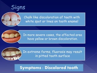 Chalk like discoloration of teeth with
white spot or lines on tooth enamel
In more severe cases, the affected area
have yellow or brown discoloration.
In extreme forms, fluorosis may result
in pitted tooth surface
Symptoms : Discolored tooth
 