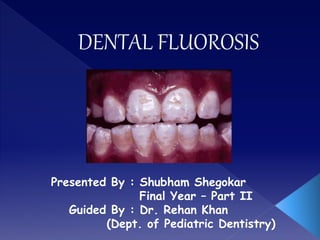 Presented By : Shubham Shegokar
Final Year – Part II
Guided By : Dr. Rehan Khan
(Dept. of Pediatric Dentistry)
 