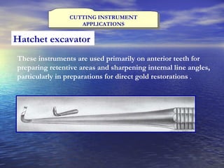 CUTTING INSTRUMENT APPLICATIONS Hatchet excavator   These instruments are used primarily on anterior teeth for preparing retentive areas and sharpening internal line angles, particularly in preparations for direct gold restorations  . 