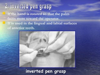 2. inverted pen grasp If the hand is rotated so that the palm faces more toward the operator. If is used in the lingual and labial surfaces of anterior teeth. inverted pen grasp 