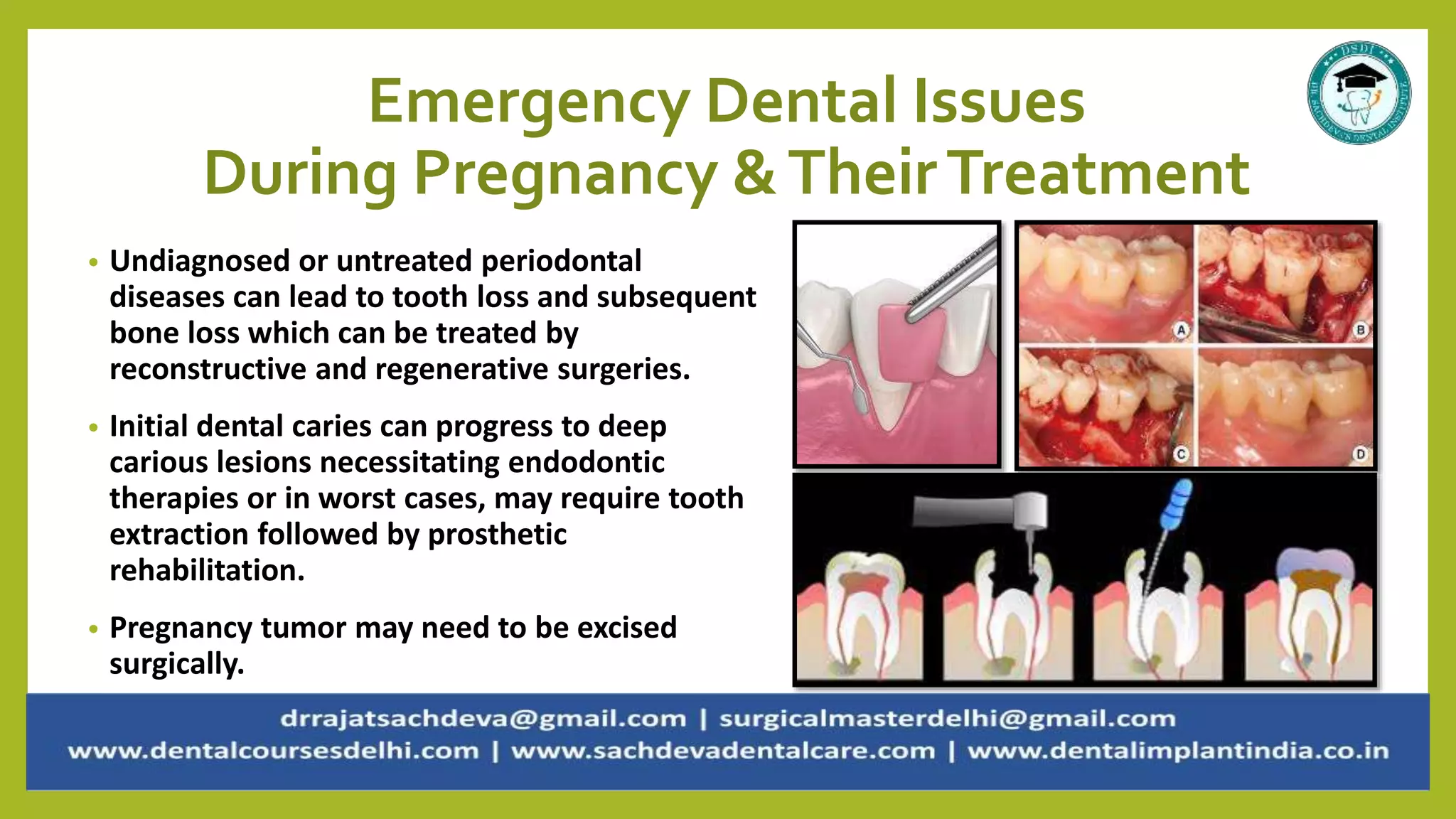 Dental health during pregnancy and how to avoid common dental problems ...