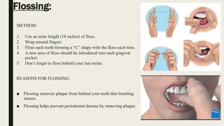 Dental health education | PPTX