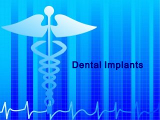 Dental Implants

 