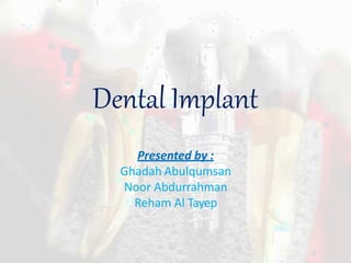 Dental Implant
Presented by :
Ghadah Abulqumsan
Noor Abdurrahman
Reham Al Tayep
 