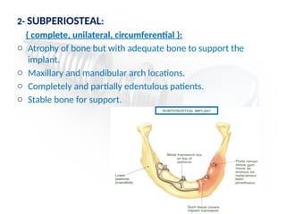 2- SUBPERIOSTEAL:
( complete, unilateral, circumferential ):
o Atrophy of bone but with adequate bone to support the
implant.
o Maxillary and mandibular arch locations.
o Completely and partially edentulous patients.
o Stable bone for support.
 