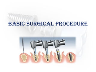 Basic Surgical procedure
 