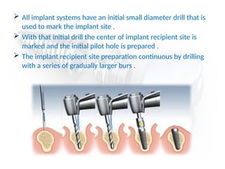  All implant systems have an initial small diameter drill that is
used to mark the implant site .
 With that initial drill the center of implant recipient site is
marked and the initial pilot hole is prepared .
 The implant recipient site preparation continuous by drilling
with a series of gradually larger burs .
 
