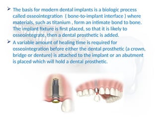  The basis for modern dental implants is a biologic process
called osseointegration ( bone-to-implant interface ) where
materials, such as titanium , form an intimate bond to bone.
The implant fixture is first placed, so that it is likely to
osseointegrate, then a dental prosthetic is added.
 A variable amount of healing time is required for
osseointegration before either the dental prosthetic (a crown,
bridge or denture) is attached to the implant or an abutment
is placed which will hold a dental prosthetic.
 