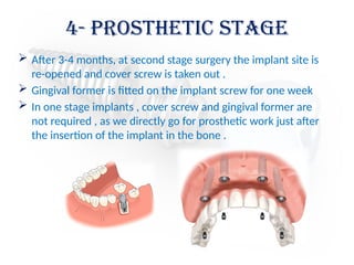  After 3-4 months, at second stage surgery the implant site is
re-opened and cover screw is taken out .
 Gingival former is fitted on the implant screw for one week
 In one stage implants , cover screw and gingival former are
not required , as we directly go for prosthetic work just after
the insertion of the implant in the bone .
4- prosthetic stage
 
