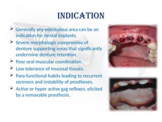 Indication
 Generally any edentulous area can be an
indication for dental implants.
 Severe morphologic compromise of
denture supporting areas that significantly
undermine denture retention.
 Poor oral muscular coordination.
 Low tolerance of mucosal tissues.
 Para-functional habits leading to recurrent
soreness and instability of prostheses.
 Active or hyper active gag reflexes, elicited
by a removable prosthesis.
 