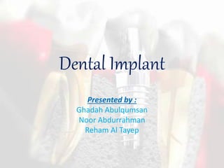 Dental Implant
Presented by :
Ghadah Abulqumsan
Noor Abdurrahman
Reham Al Tayep
 