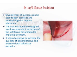 Dental implant | PPTX