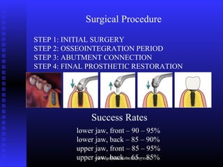 Surgical Procedure
STEP 1: INITIAL SURGERY
STEP 2: OSSEOINTEGRATION PERIOD
STEP 3: ABUTMENT CONNECTION
STEP 4: FINAL PROST...