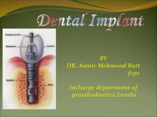 BY
DR. Aamir Mehmood Butt
fcps
Incharge department of
prosthodontics,Lumhs
 
