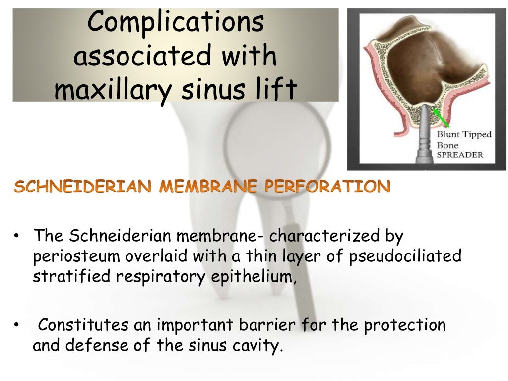 Dental implant complications