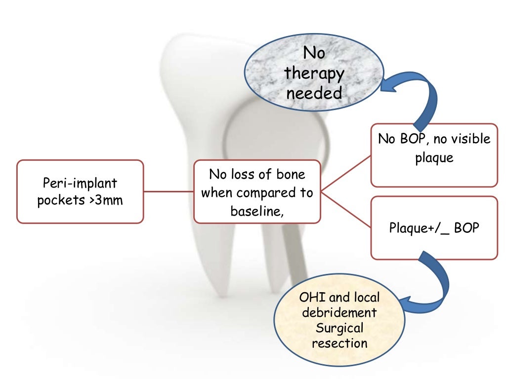 Dental implant complications