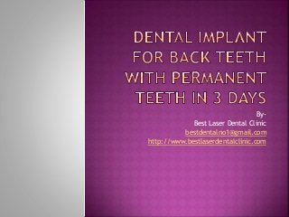 By-
Best Laser Dental Clinic
bestdentalno1@gmail.com
http://www.bestlaserdentalclinic.com
 