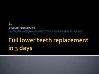 By-
Best Laser Dental Clinic
bestdentalno1@gmail.com http://www.bestlaserdentalclinic.com
 