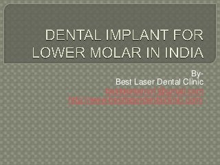 By-
Best Laser Dental Clinic
bestdentalno1@gmail.com
http://www.bestlaserdentalclinic.com/
 