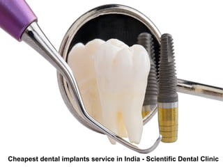 Cheapest dental implants service in India - Scientific Dental Clinic
 
