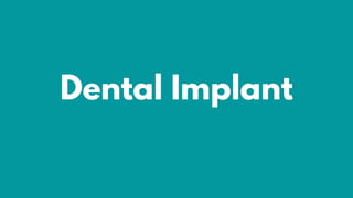 Dental Implant
 