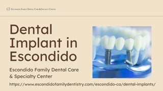 Dental
Implant in
Escondido
Escondido Family Dental Care
& Specialty Center
https://www.escondidofamilydentistry.com/escondido-ca/dental-implants/
 