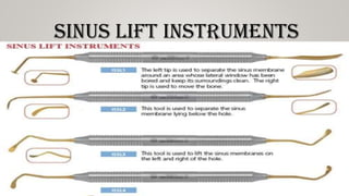 SINUS LIFT INSTRUMENTS
 