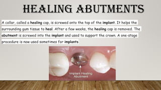 HEALING ABUTMENTS
A collar, called a healing cap, is screwed onto the top of the implant. It helps the
surrounding gum tissue to heal. After a few weeks, the healing cap is removed. The
abutment is screwed into the implant and used to support the crown. A one-stage
procedure is now used sometimes for implants.
 