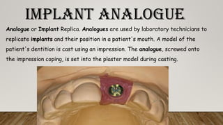 IMPLANT ANALOGUE
Analogue or Implant Replica. Analogues are used by laboratory technicians to
replicate implants and their position in a patient's mouth. A model of the
patient's dentition is cast using an impression. The analogue, screwed onto
the impression coping, is set into the plaster model during casting.
 