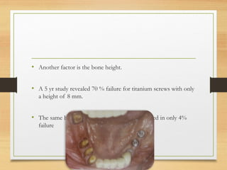 • Another factor is the bone height.
• A 5 yr study revealed 70 % failure for titanium screws with only
a height of 8 mm.
• The same height of HA coated implants resulted in only 4%
failure
 