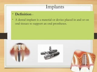 Implants
• Definition –
• A dental implant is a material or device placed in and or on
oral tissues to support an oral prostheses.
 