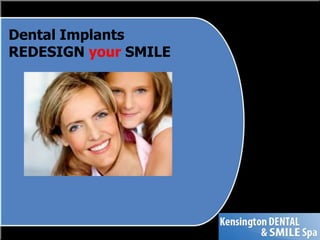 Dental ImplantsREDESIGN your SMILE 