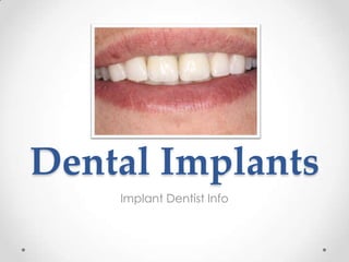 Dental Implants
    Implant Dentist Info
 