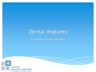 Dental Implants
By Cancun Cosmetic Dentistry

 