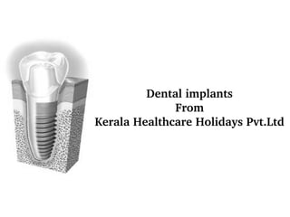 Dental implants
From
Kerala Healthcare Holidays Pvt.Ltd

 